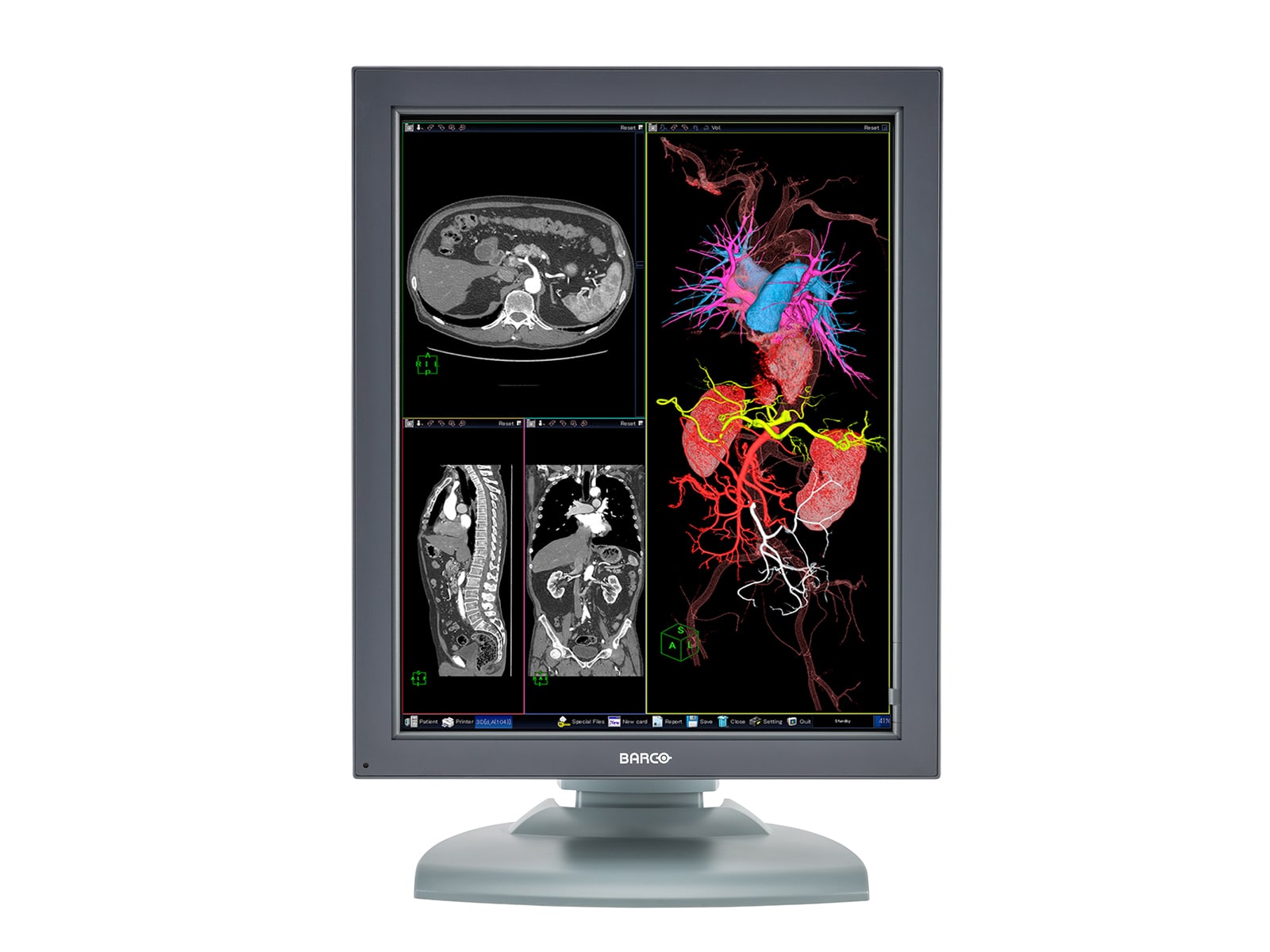 Monitor Médico Barco MDNC-3121 3MP – 21" – Color – Radiología Diagnóstica DICOM (3)