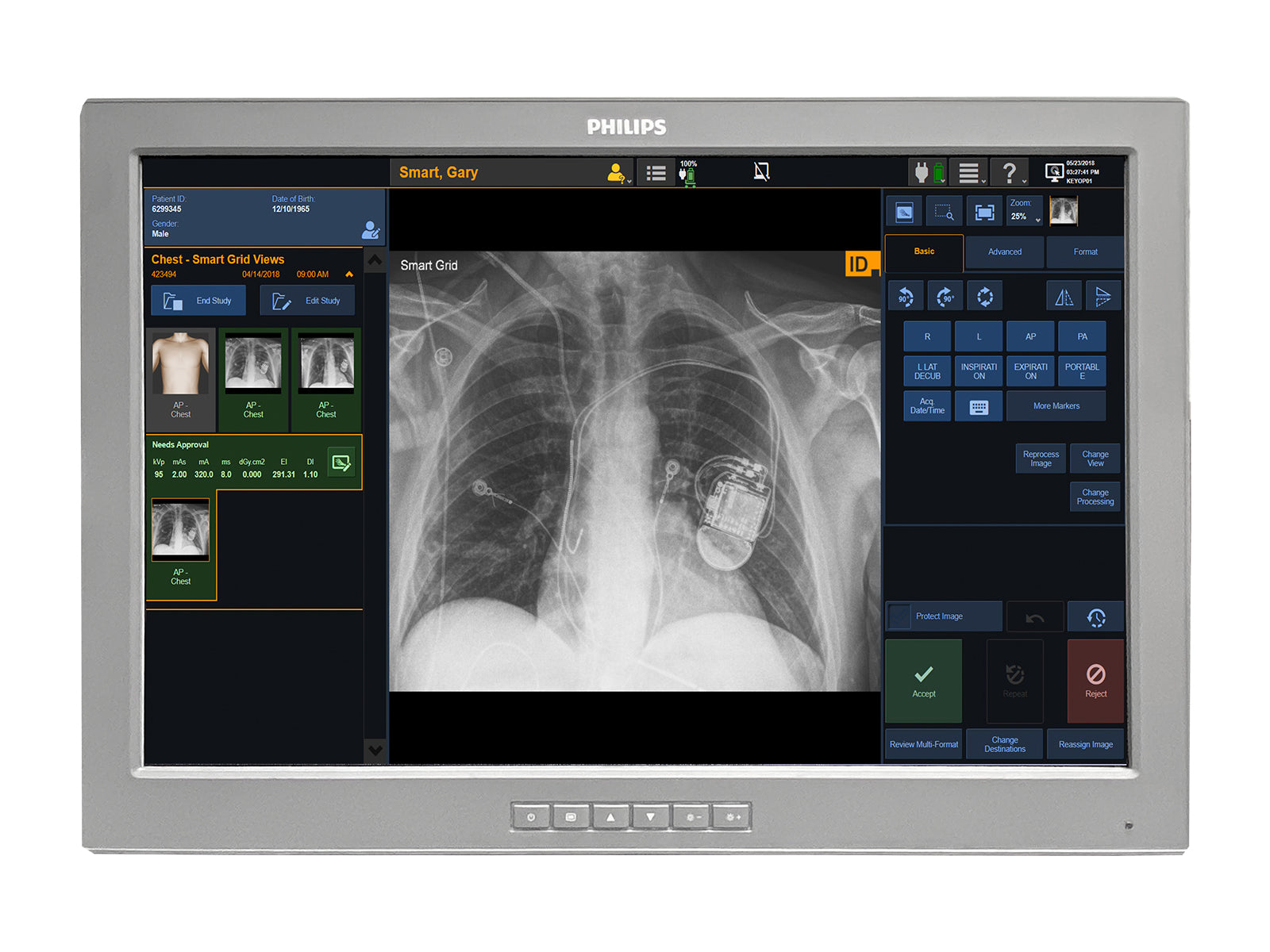 Monitor Médico Barco P240-LA 2MP – 24" – Uso Quirúrgico DICOM (1)
