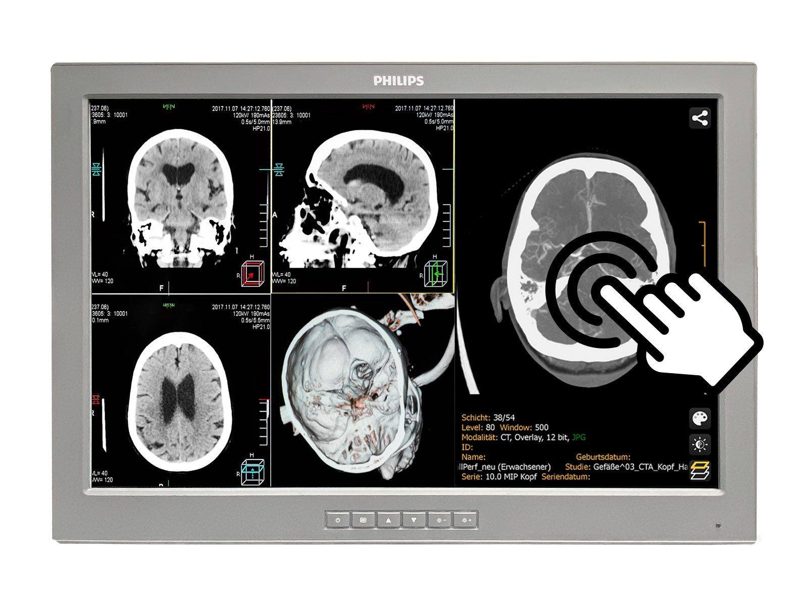 Monitor Médico Barco P240-LT 2MP – 24" – Uso Quirúrgico DICOM (1)