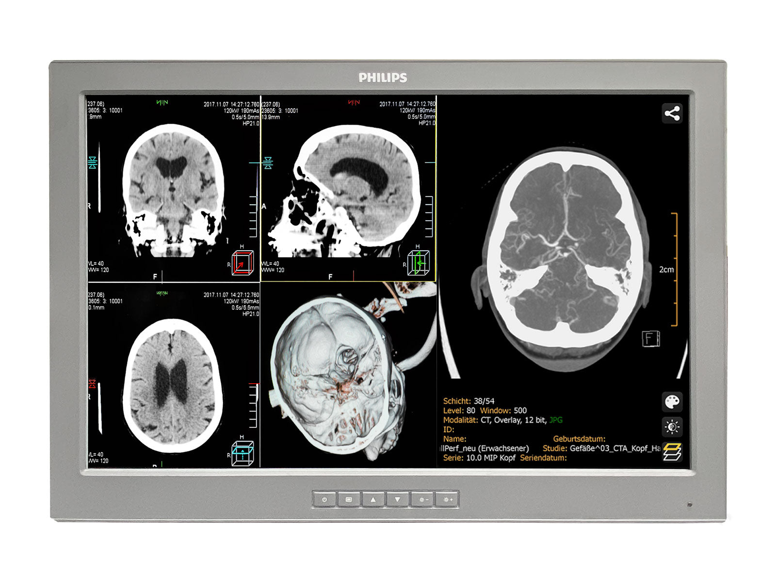Monitor Médico Barco P240-LT 2MP – 24" – Uso Quirúrgico DICOM (2)