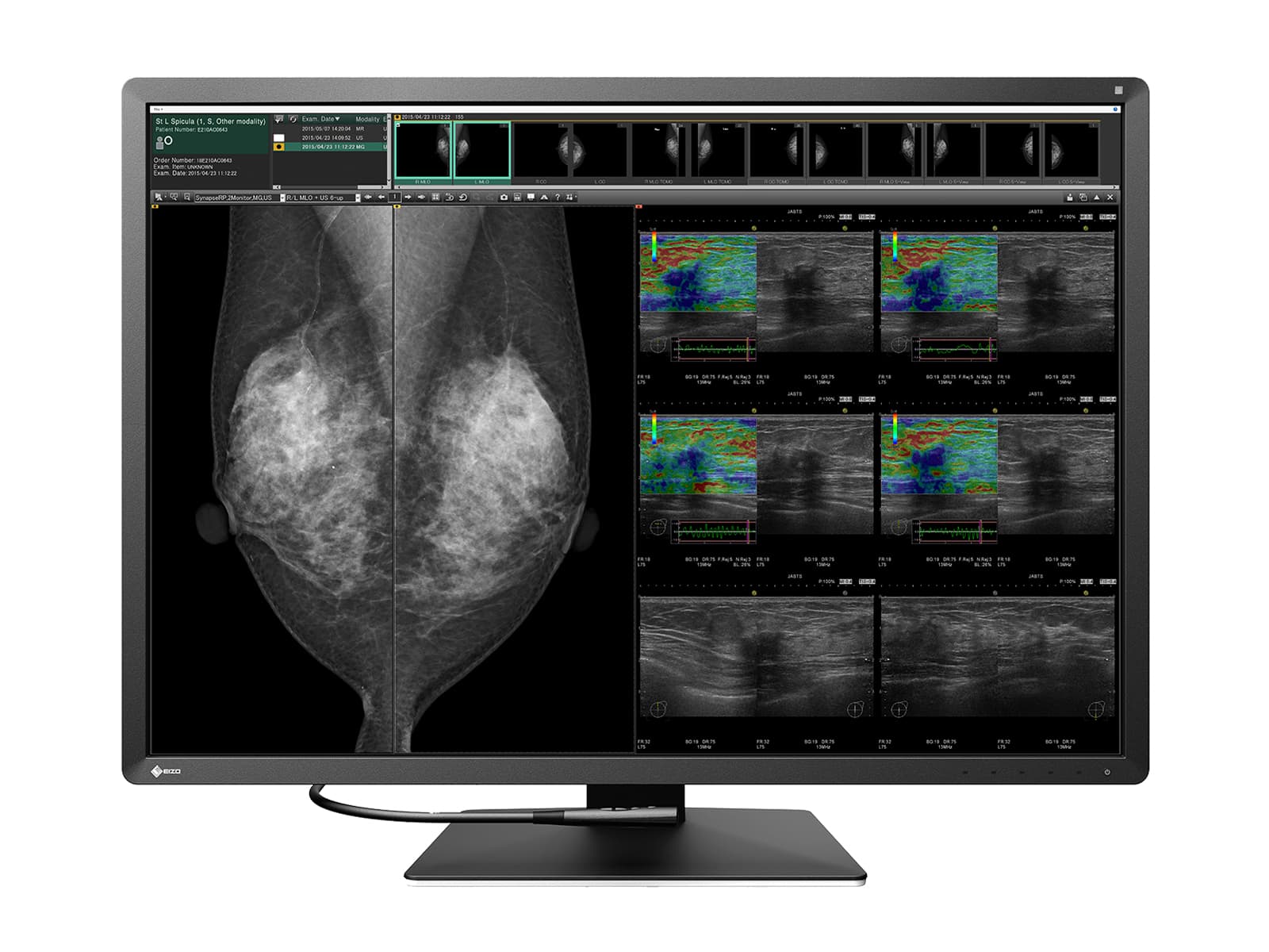Estación de Lectura de Mamografía PACS Eizo RX1270Z4G5 – 12MP – Color – Sistema Completo (2)