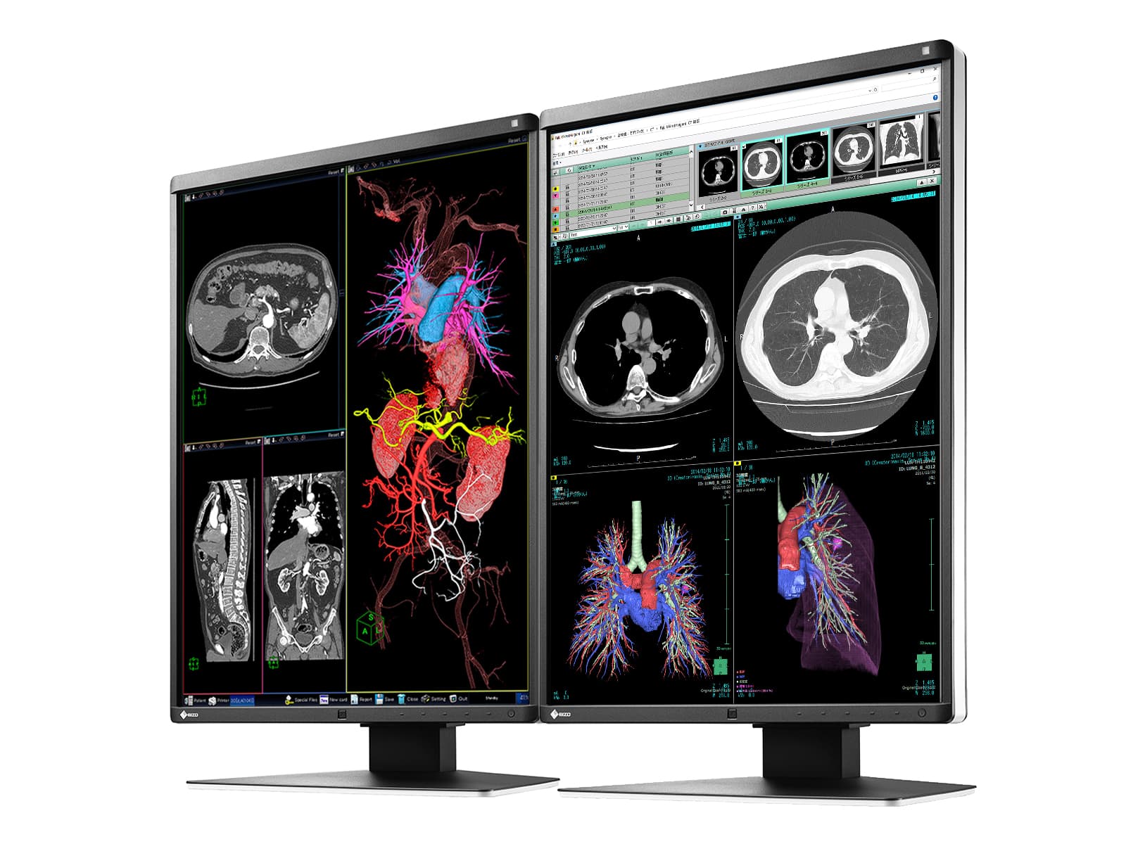 Monitor Médico Eizo RX360 3MP – 21" – Color – Radiología Diagnóstica DICOM (2)