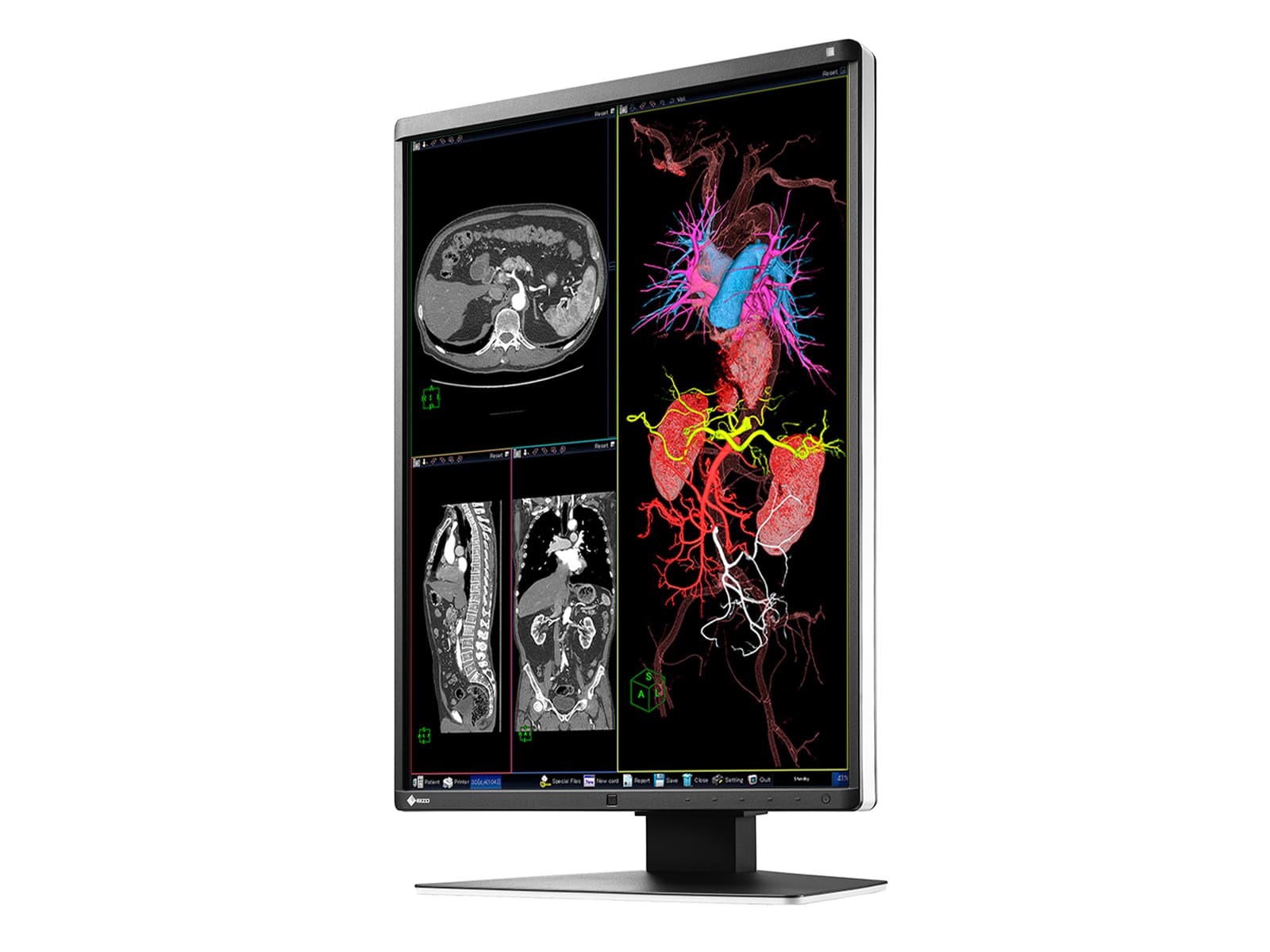 Monitor Médico Eizo RX360 3MP – 21" – Color – Radiología Diagnóstica DICOM (5)