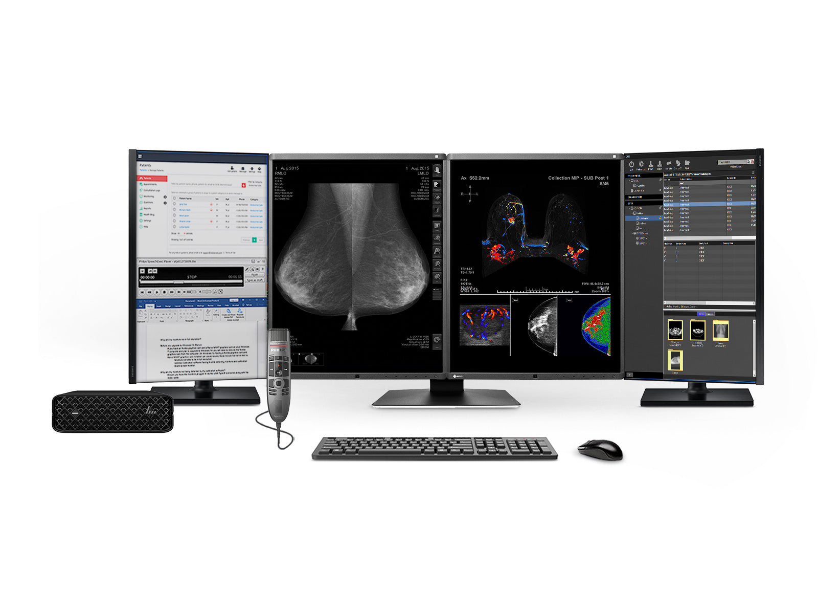 Estación de Lectura de Mamografía PACS Eizo RX560Z2MNG9 – 5MP – Color – Sistema Completo (1)