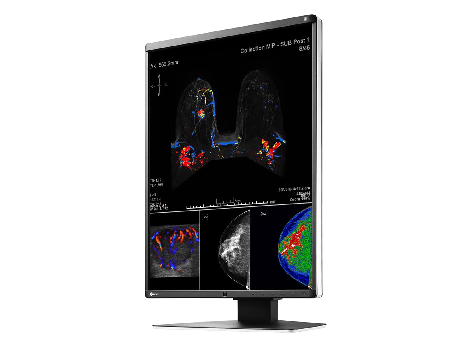 Monitor Médico Eizo RX560-BK 5MP – 21" – Color – Radiología Diagnóstica DICOM (5)