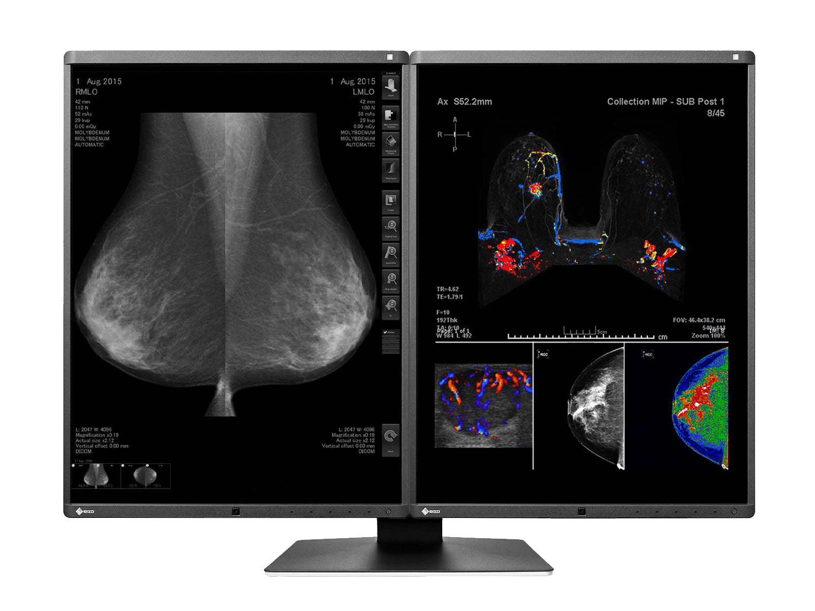 Estación de Lectura de Mamografía PACS Eizo RX560Z4G5 – 5MP – Color – Sistema Completo (2)