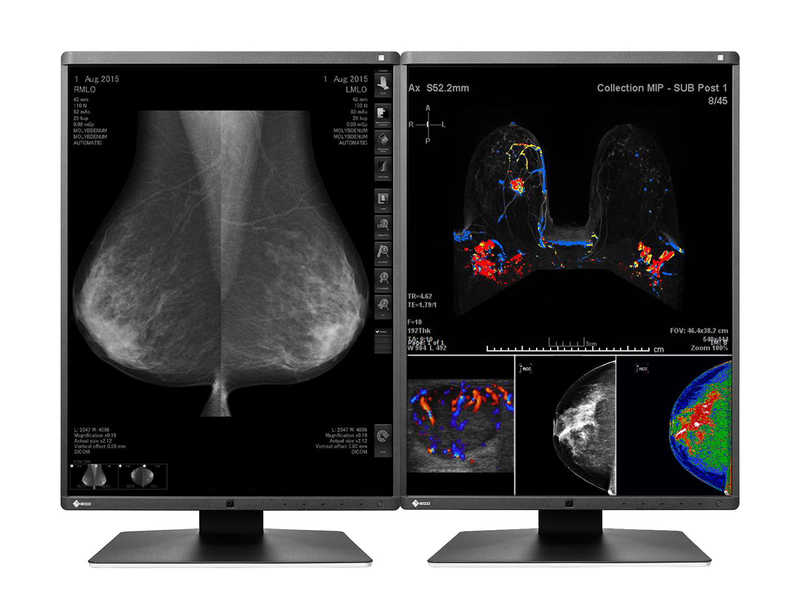 Monitor Médico Eizo RX560-BK 5MP – 21" – Color – Radiología Diagnóstica DICOM (2)