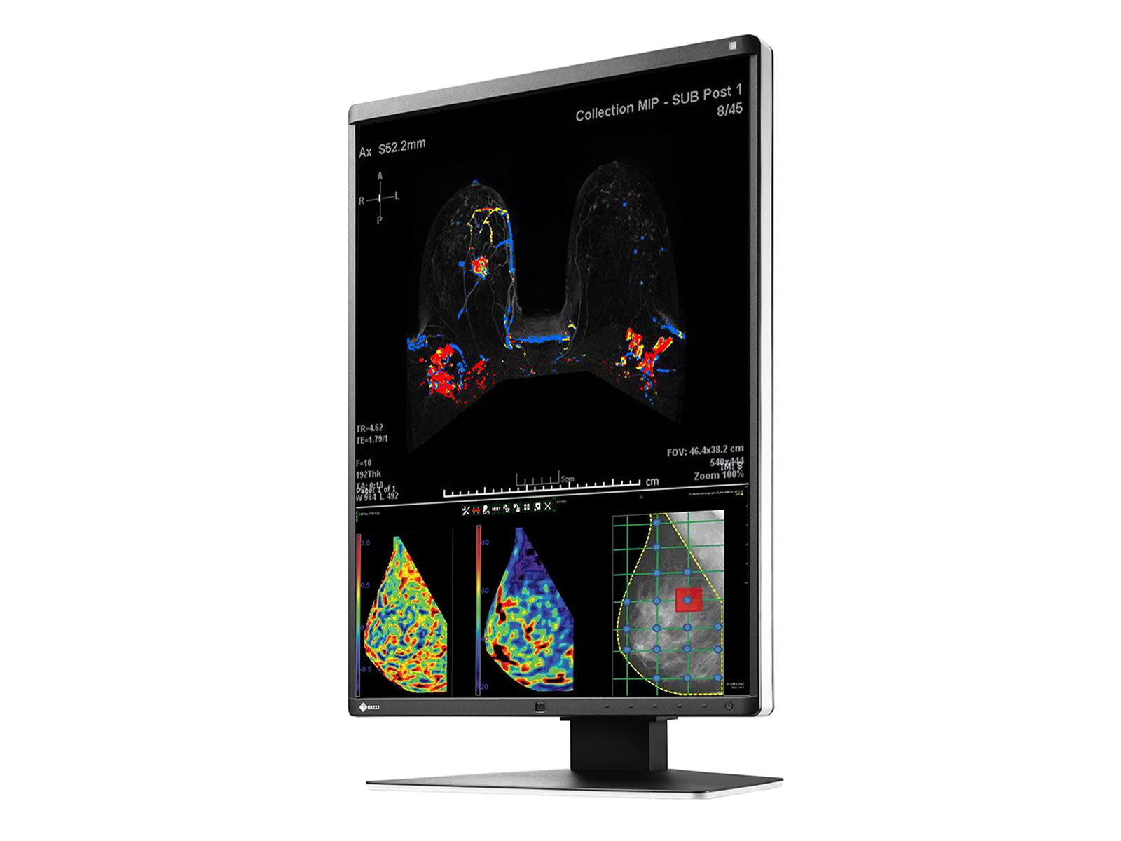 Monitor Médico Eizo RX570-BK 5MP – 21" – Color – Radiología Diagnóstica DICOM (5)