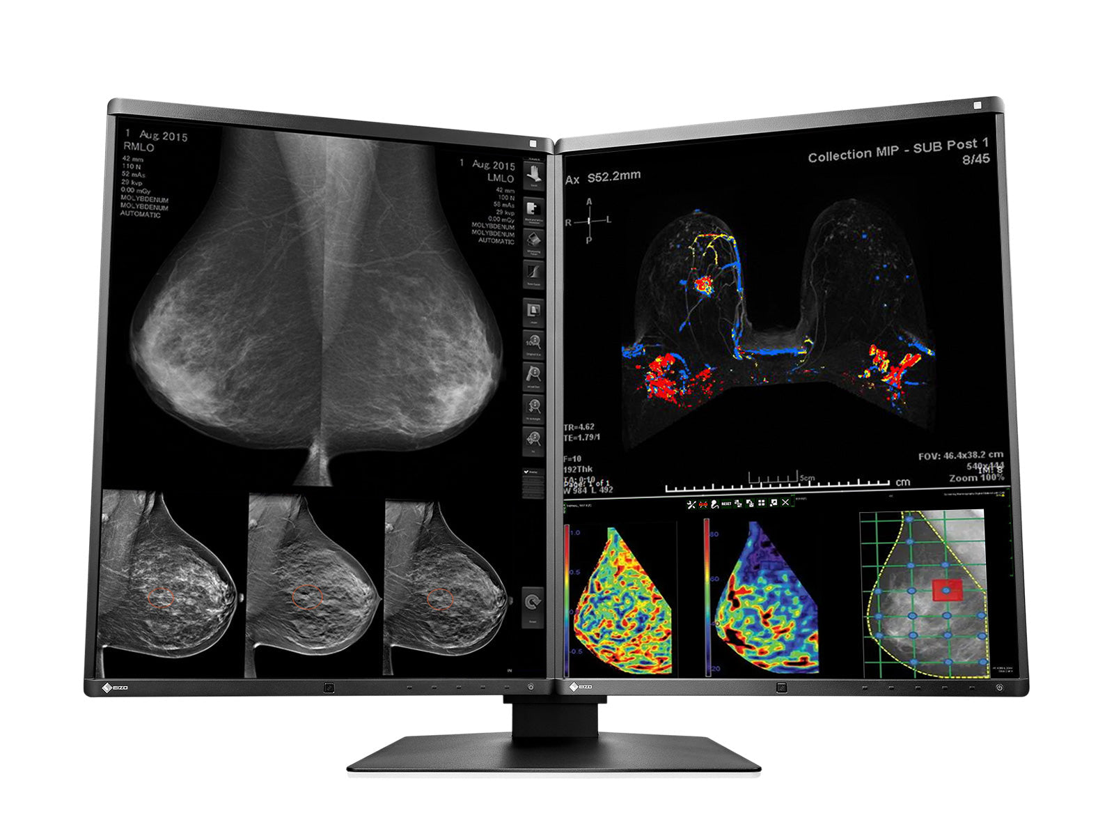 Monitor Médico Eizo RX570-BK 5MP – 21" – Color – Radiología Diagnóstica DICOM (2)
