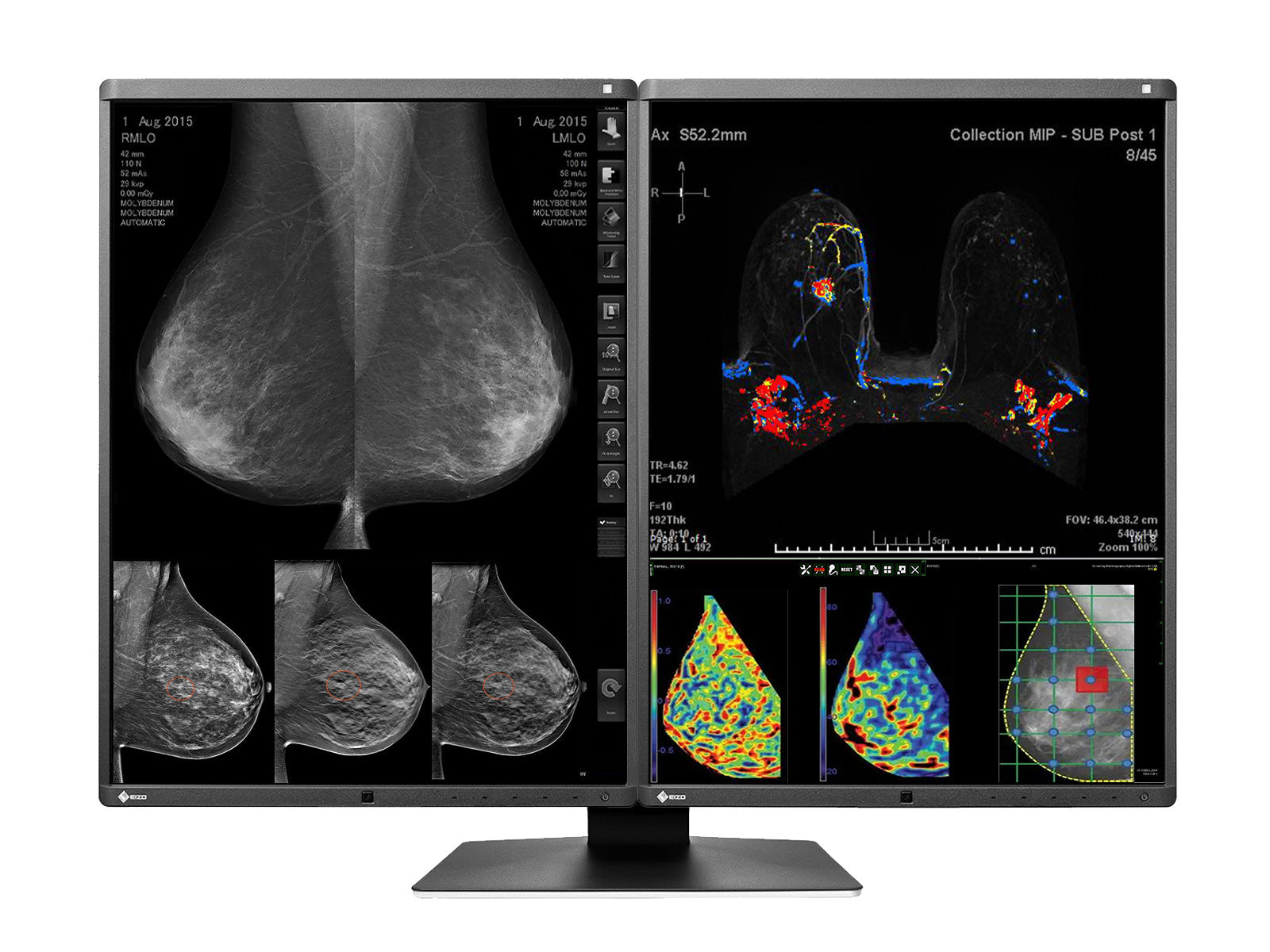 Monitor Médico Eizo RX570-BK 5MP – 21" – Color – Radiología Diagnóstica DICOM (1)