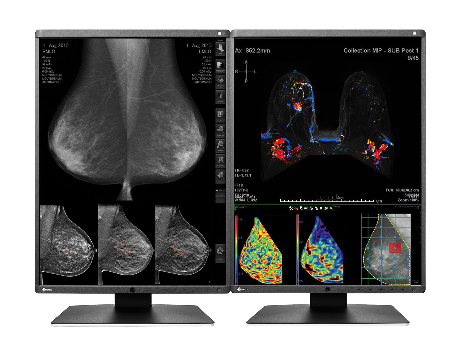 Monitor Médico Eizo RX570-BK 5MP – 21" – Color – Radiología Diagnóstica DICOM (3)