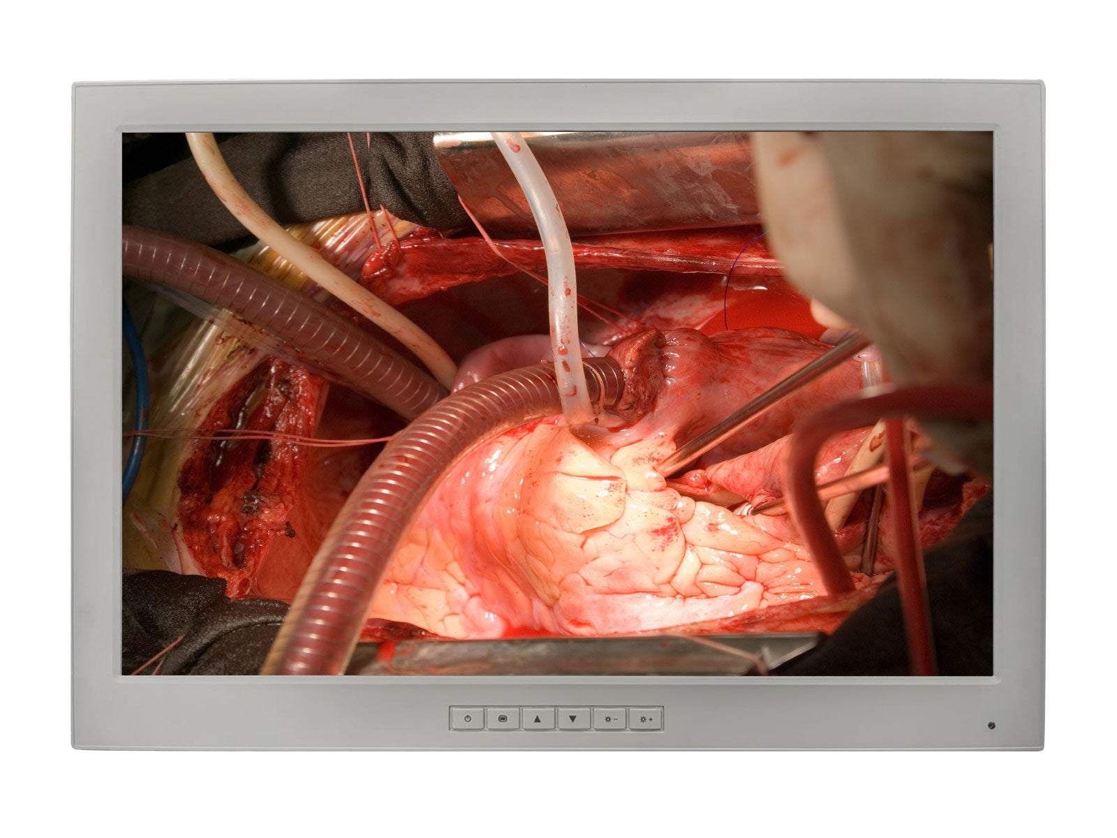 Monitor Médico Barco MED24ESH 2MP – 24" – Uso Quirúrgico DICOM (1)