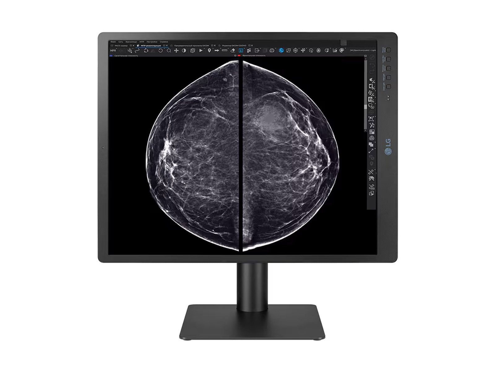 Monitor Médico LG 21HQ613D-B 5MP – 21" – Color – Radiología Diagnóstica DICOM (3)
