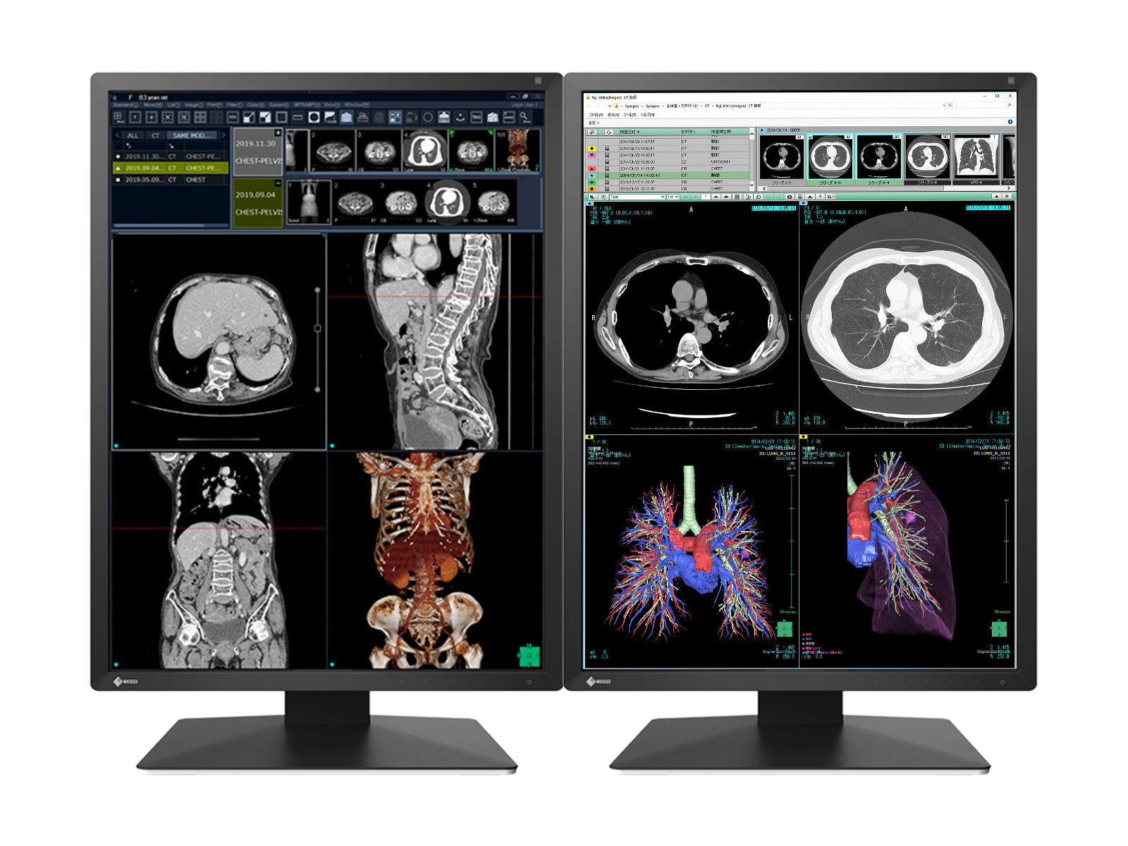 Monitor Médico Eizo RX270-BK 2MP – 21" – Color – Radiología Diagnóstica DICOM (1)