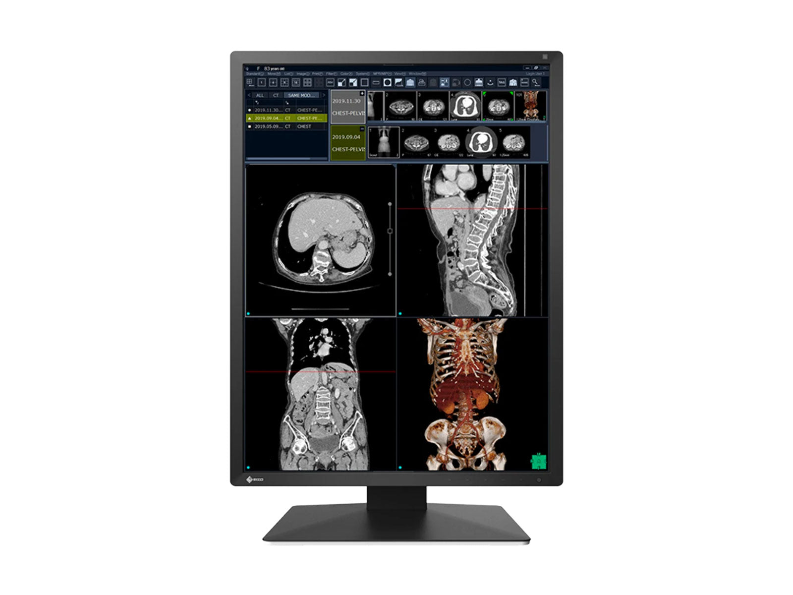 Monitor Médico Eizo RX270-BK 2MP – 21" – Color – Radiología Diagnóstica DICOM (2)