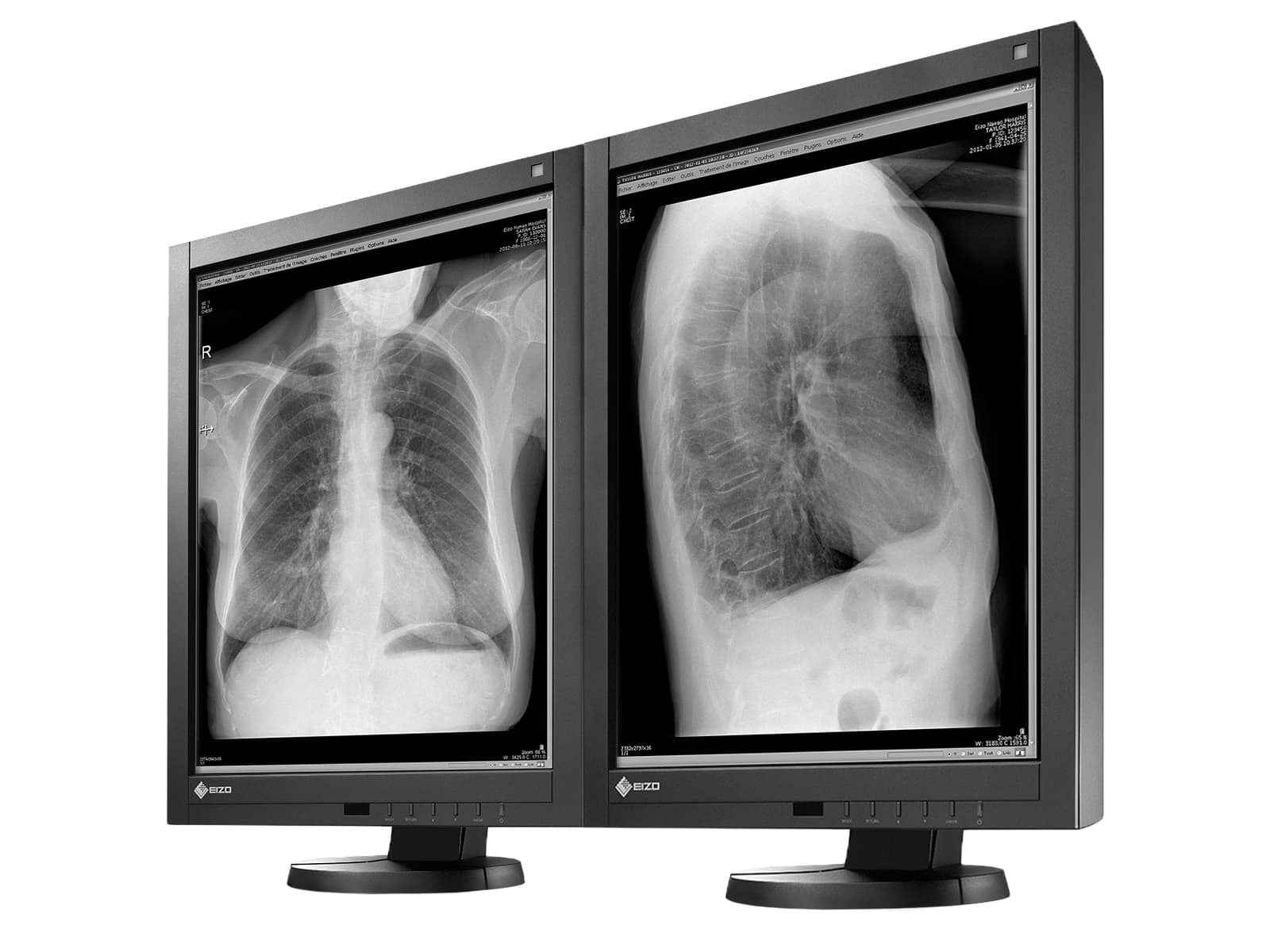 Monitor Médico Eizo GX240 2MP – 21" – Escala de grises – Radiología Diagnóstica DICOM (2)