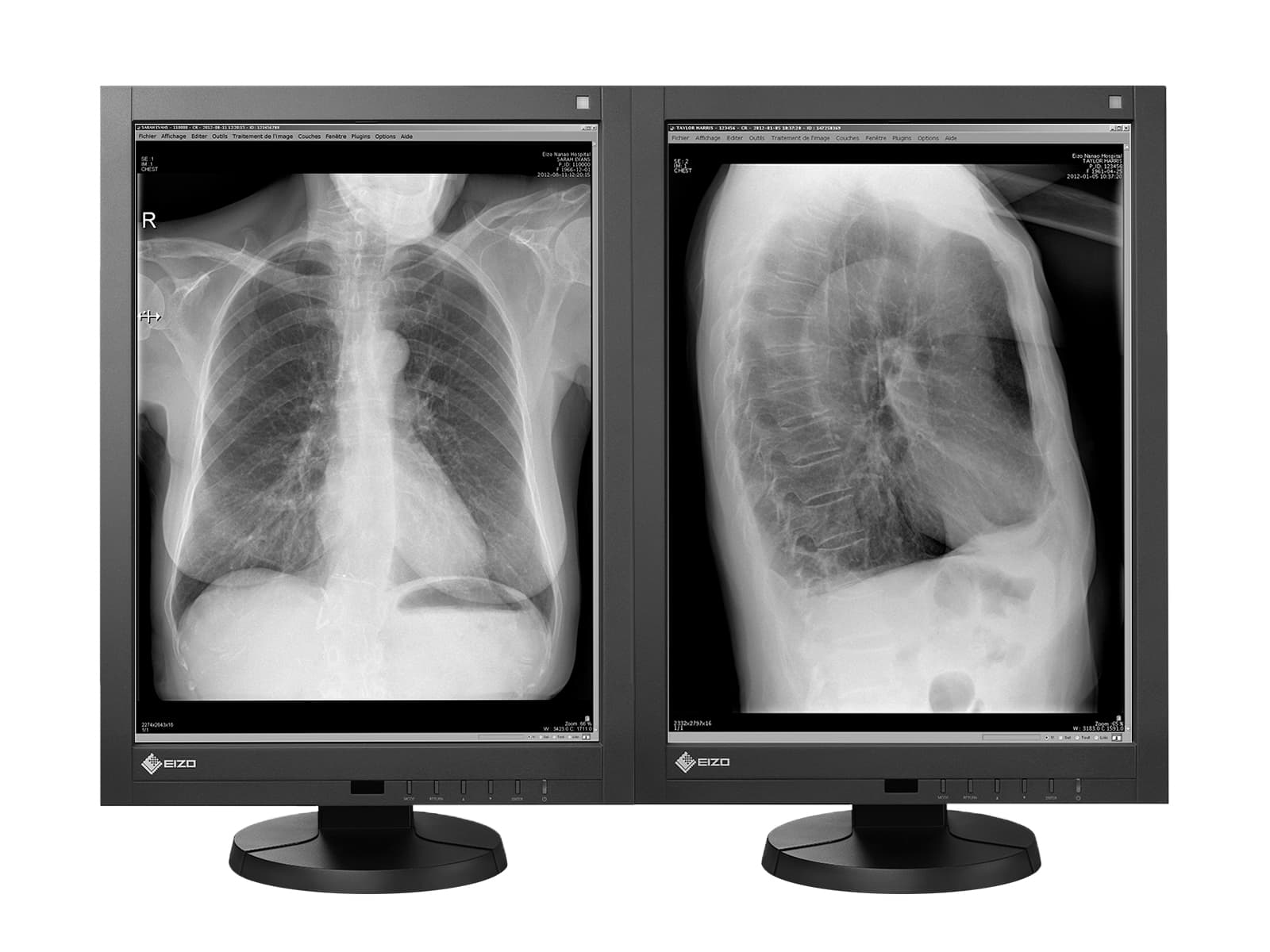 Monitor Médico Eizo GX240 2MP – 21" – Escala de grises – Radiología Diagnóstica DICOM (1)
