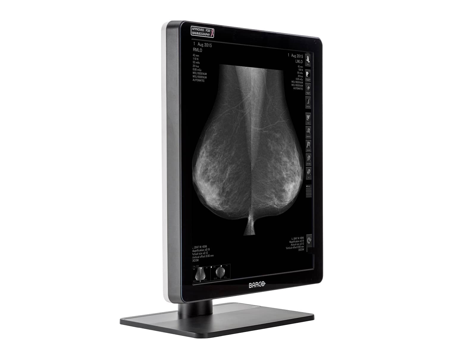 Monitor Médico Barco MDCG-5221 5MP – 21.3" – Escala de grises – Radiología Diagnóstica DICOM (4)