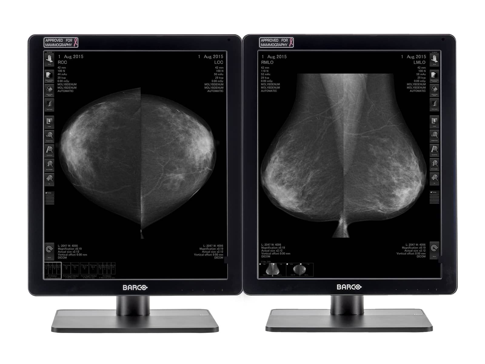 Monitor Médico Barco MDCG-5221 5MP – 21.3" – Escala de grises – Radiología Diagnóstica DICOM (1)