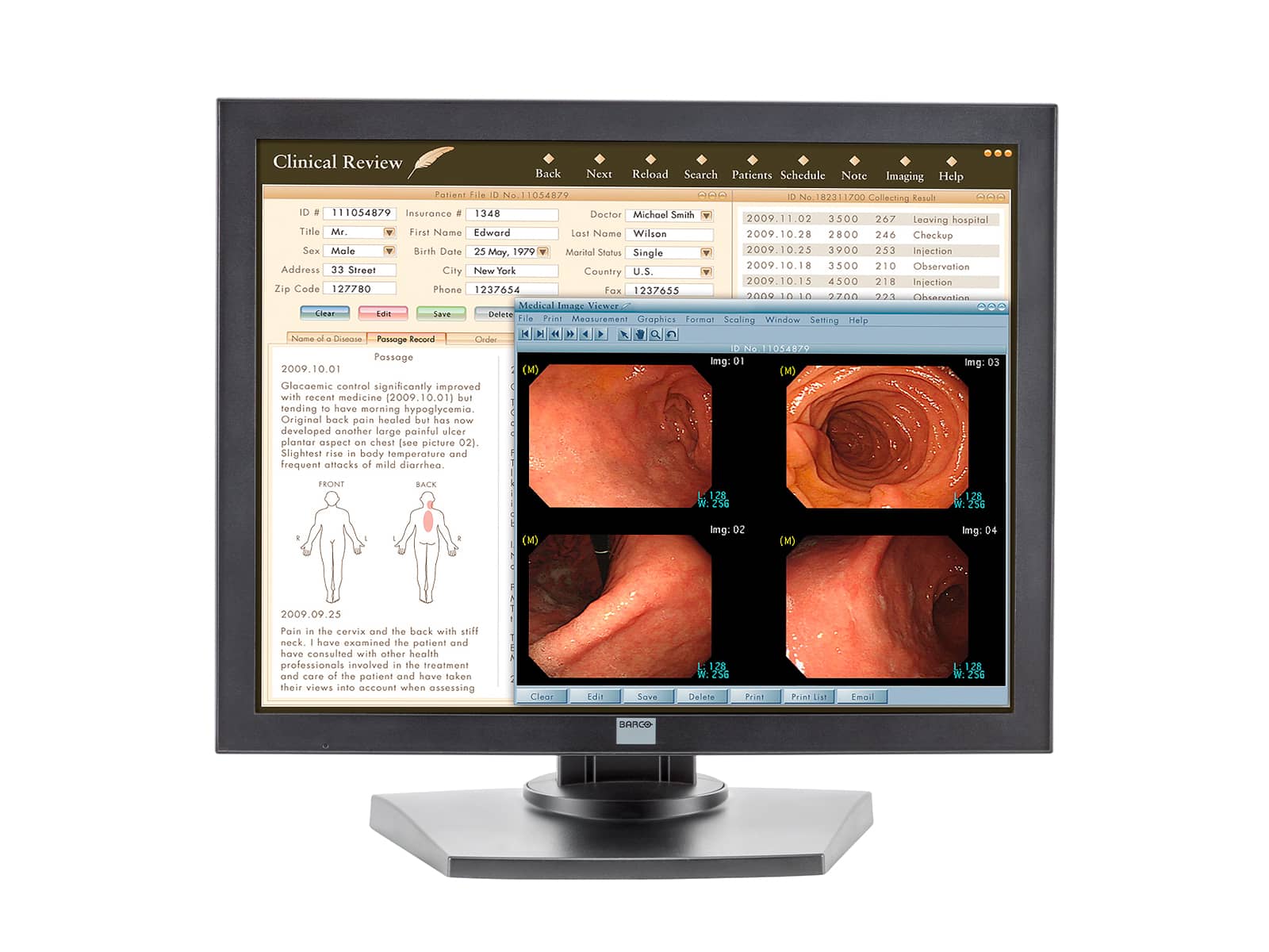 Monitor Médico Barco MDRC-1119 1MP – 19" – Color – Revisión Clínica DICOM (1)