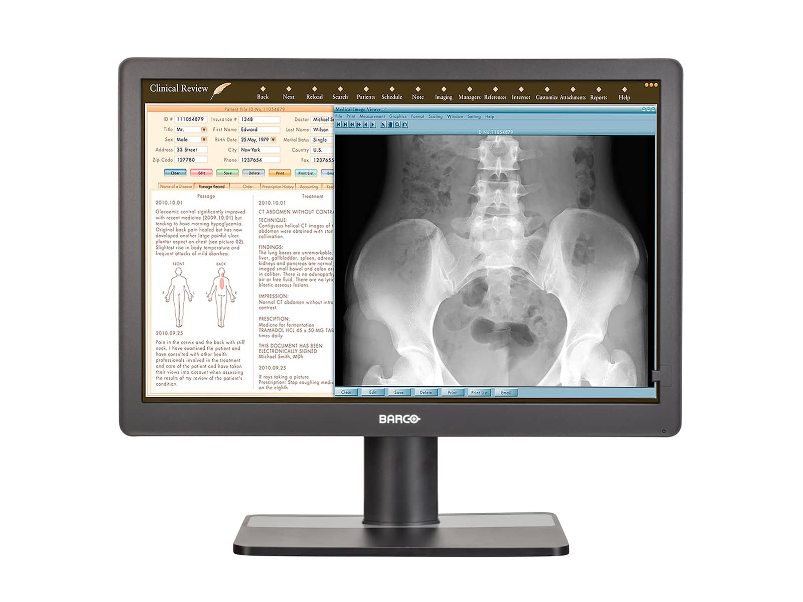 Monitor Médico Barco MDRC-2222 2MP – 22" – Revisión Clínica (1)