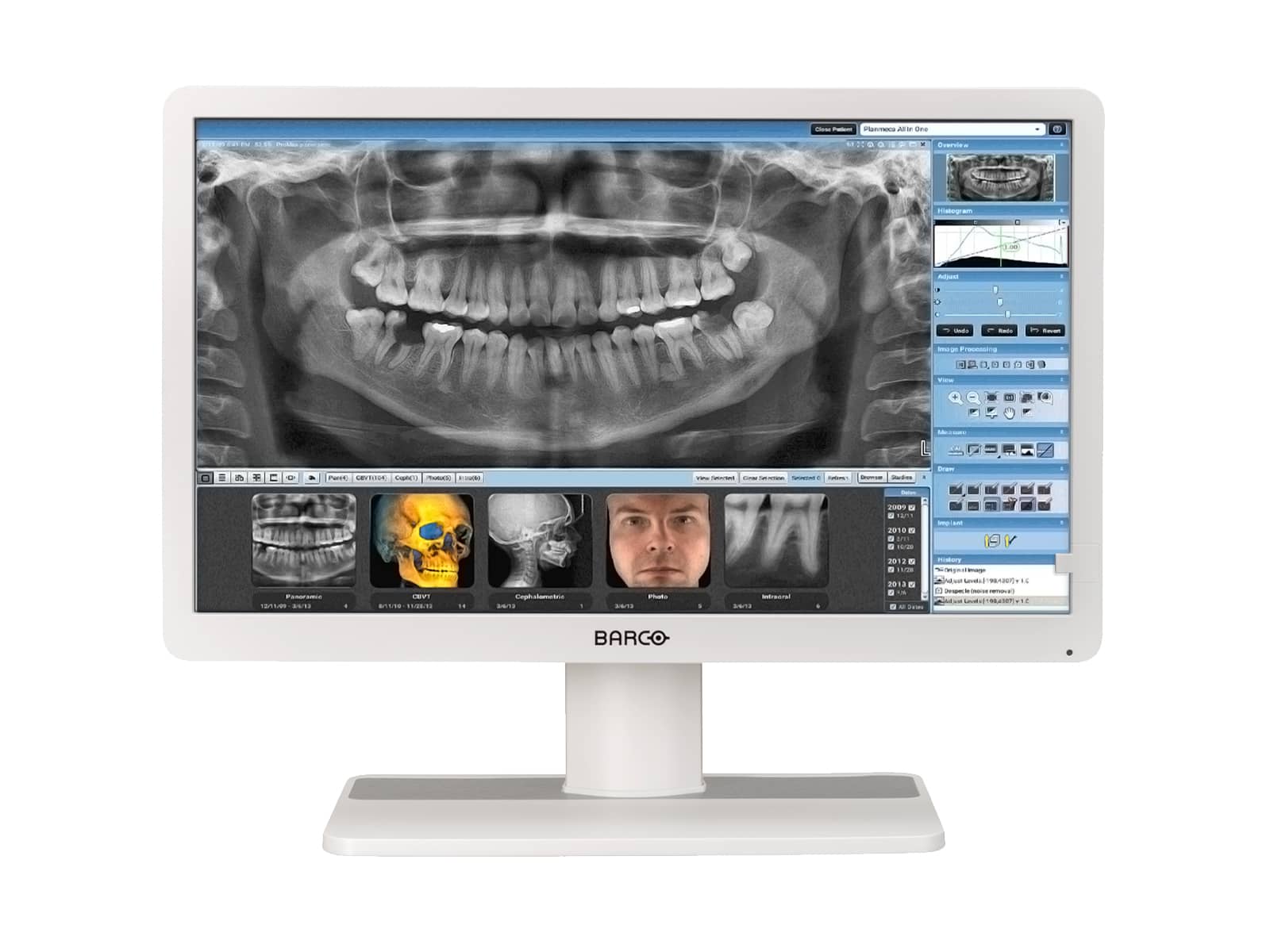 Monitor Médico Barco MDRC-2222 2MP – 22" – Revisión Clínica (1)