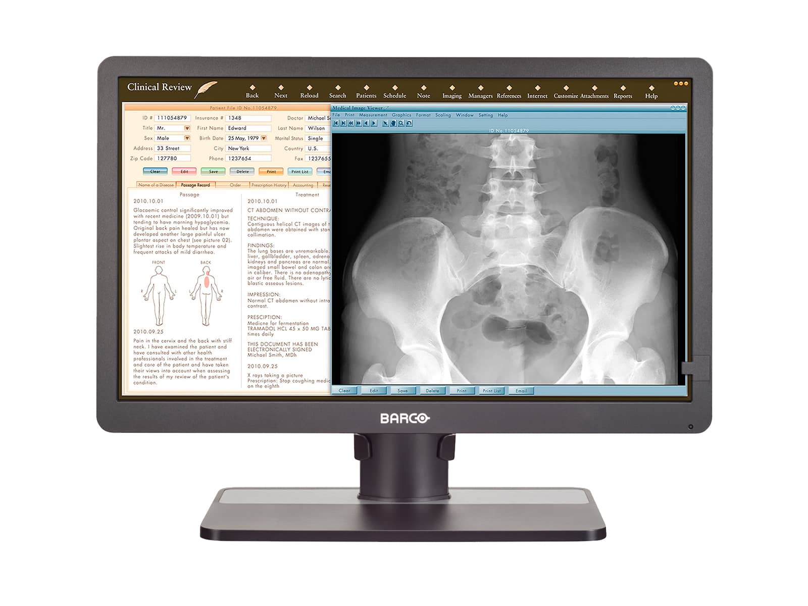 Monitor Médico Barco MDRC-2324 2MP – 24" – Revisión Clínica (1)