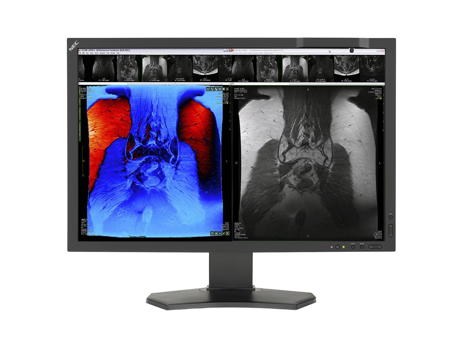 Monitor Médico NEC MD242C2 2.3MP – 24" – Color – Radiología Diagnóstica DICOM (1)