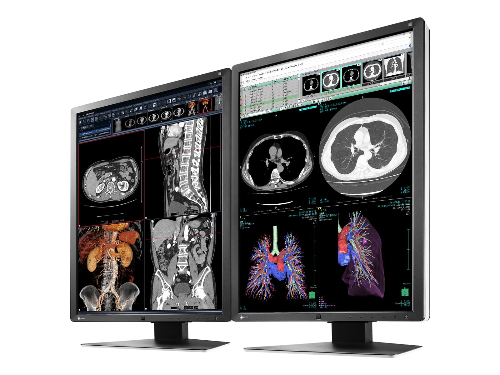 Monitor Médico Eizo RX250-BK 2MP – 21" – Color – Radiología Diagnóstica DICOM (2)