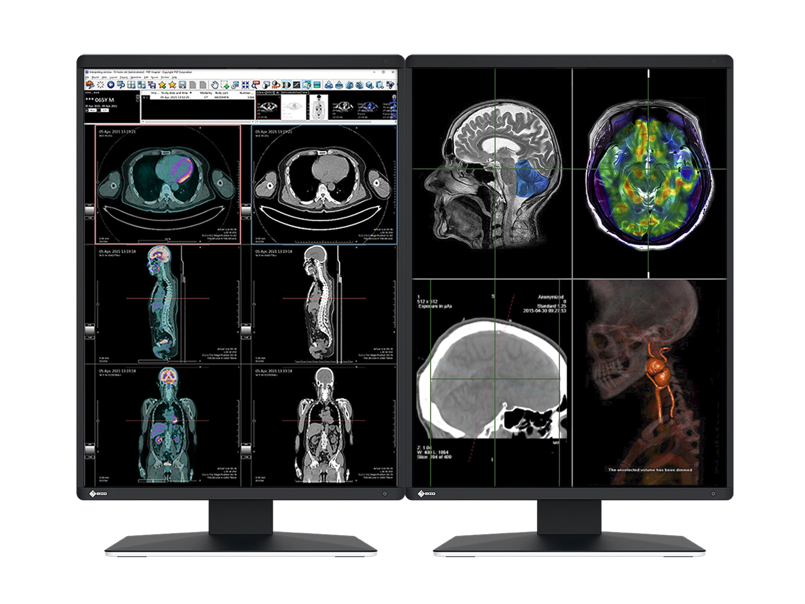 Monitor Médico Eizo RX370 3MP – 21.3" – Color – Radiología Diagnóstica DICOM (1)