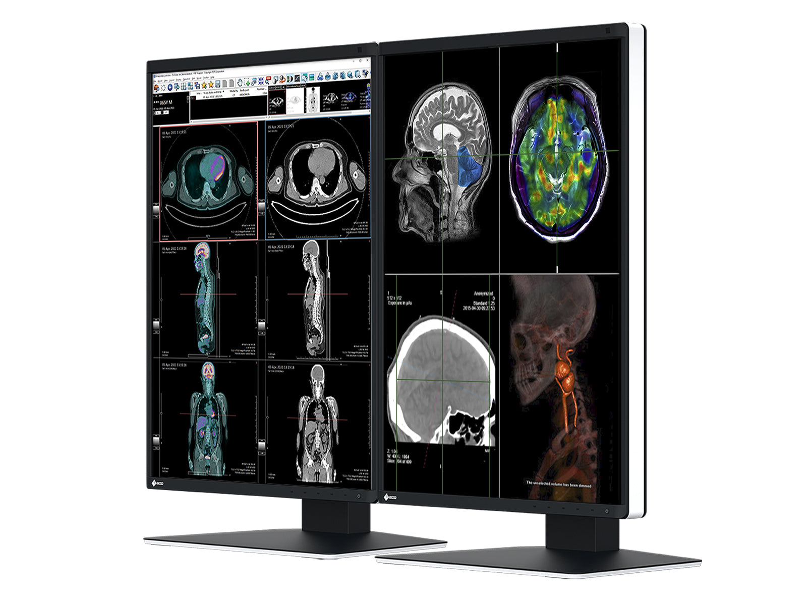 Monitor Médico Eizo RX370 3MP – 21.3" – Color – Radiología Diagnóstica DICOM (2)